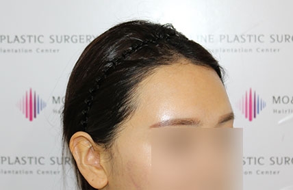 치료후기 이미지
